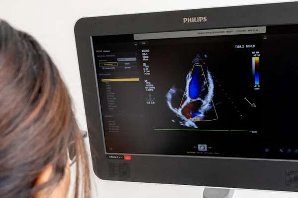 This is a photo of the technology at Almira Medical.